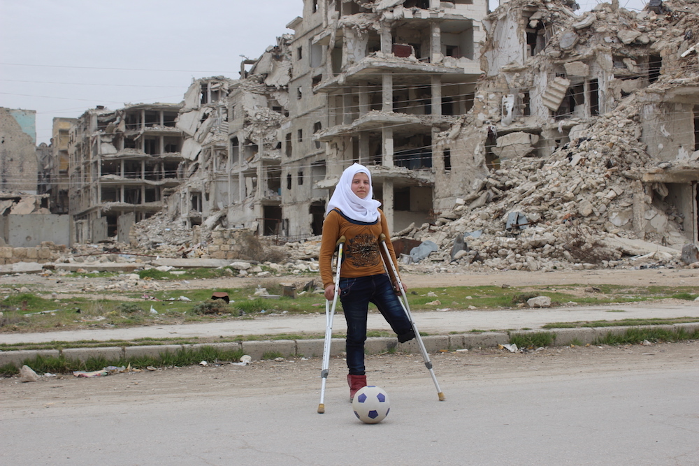 Saja Aged 13 Lost A Leg In An Attack That Killed Her Four Best Friends In Aleppo Two Years Ago