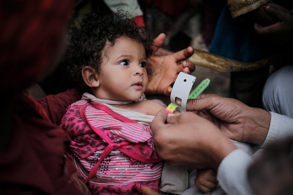 Yemen Malnutrition End of year emergencies 2