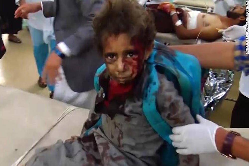 Yemeni Boy Victim Of School Bus Air Strike