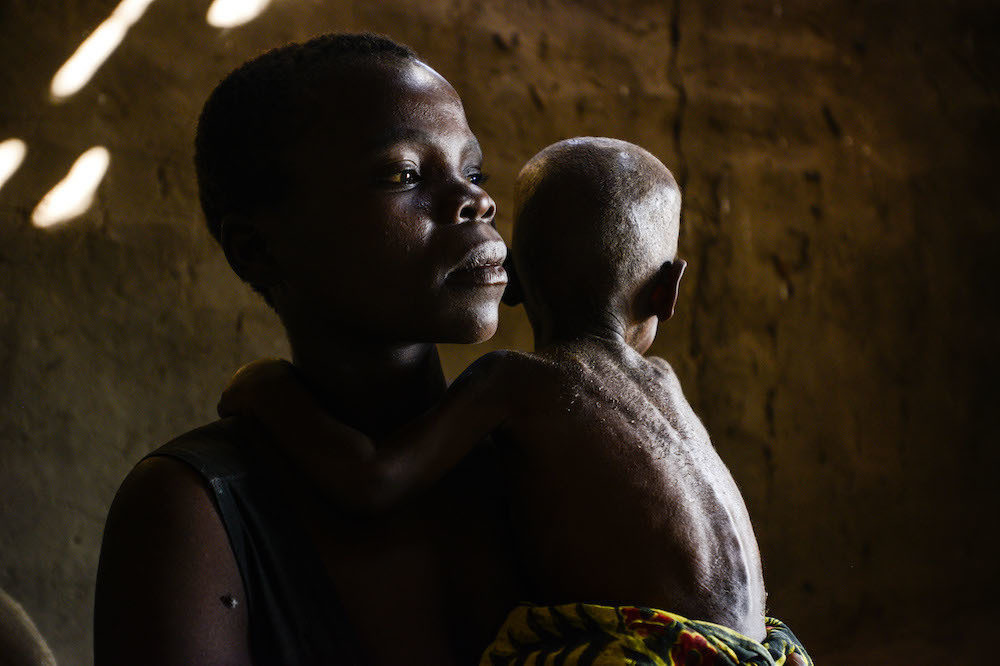 Child Marriage Africa Cost 2