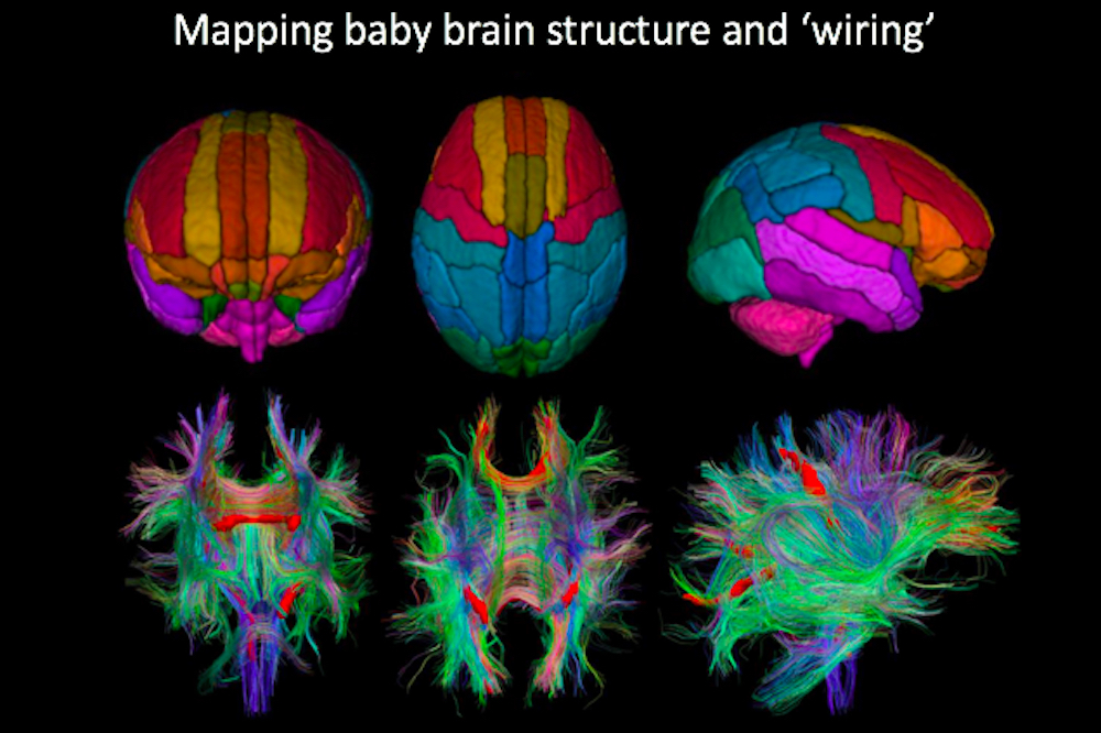 Brain Structure Map From James Boardman Talk